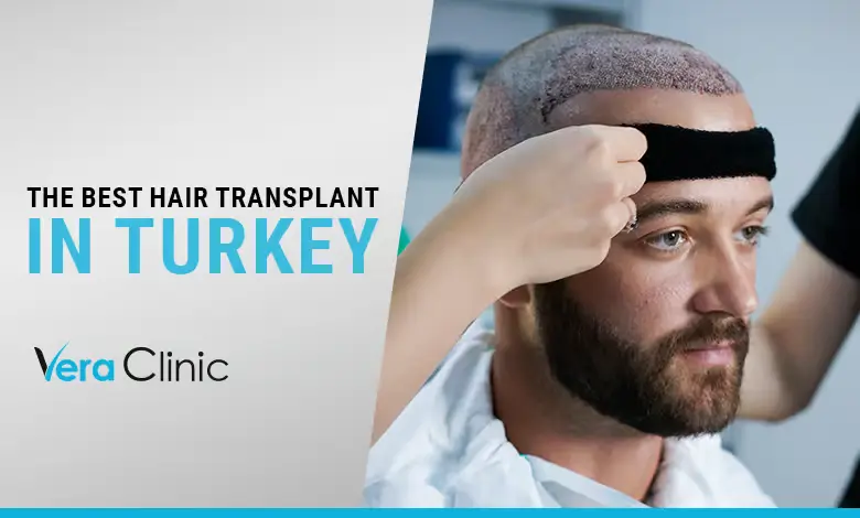 Vera Clinic Review – Leading Hair Transplant Clinic in Turkey 1 The Best Hair Transplant in Turk