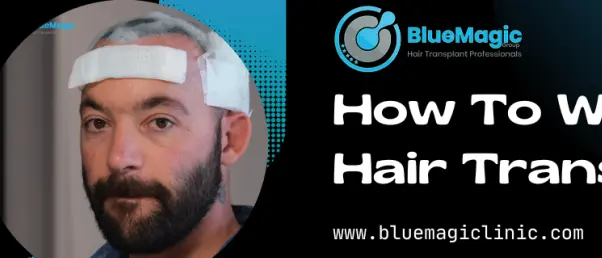 BlueMagic Clinic: Contact, Locations & Hair Transplant Info (UK & Turkey) 1 1657010988198
